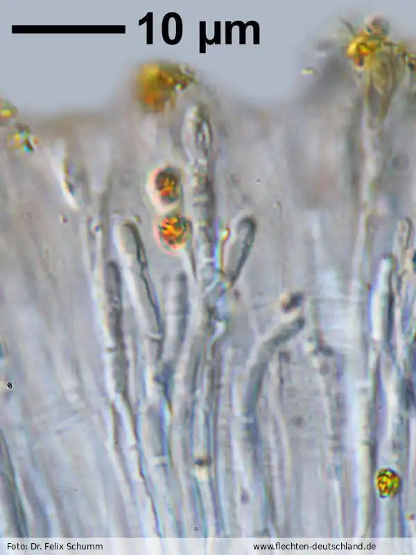 Mikromerkmale | Foto von Dr. Felix Schumm