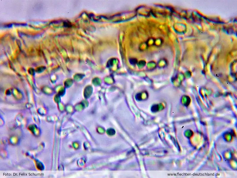 Mikromerkmale | Foto von Dr. Felix Schumm