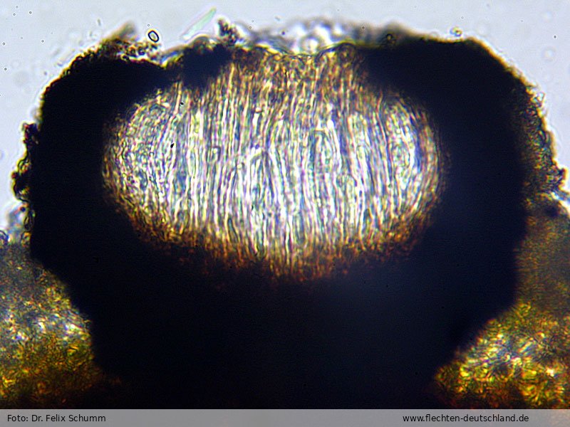 Fruchtkörper | Foto von Dr. Felix Schumm