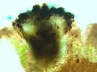 Sclerococcum montagnei Hafellner