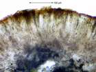 Acarospora placodiiformis H. Magn.