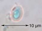 Acarospora placodiiformis H. Magn.