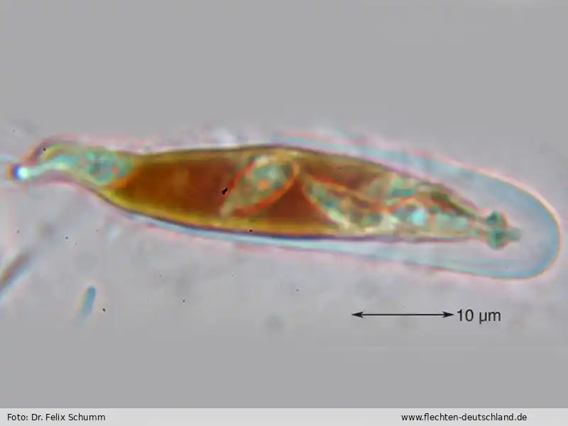 Sporen | Foto von Dr. Felix Schumm