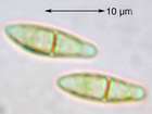 Anisomeridium polypori (Ellis & Everh.) M. E. Barr