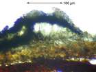 Arthonia ruana A. Massal