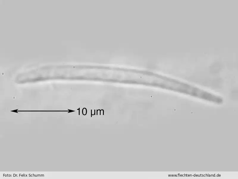 Querschnitt Fruchtkörper | Foto von Dr. Felix Schumm