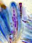 Bacidia bagliettoana (A. Massal. & De Not.) Jatta