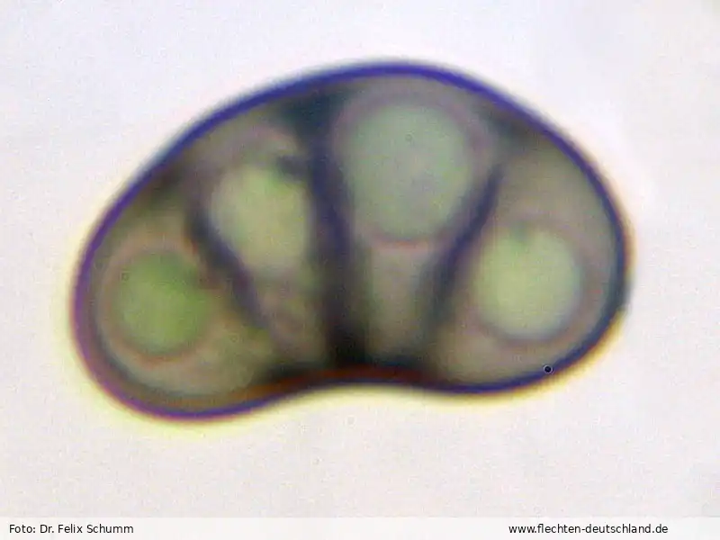 Querschnitt Fruchtkörper | Foto von Dr. Felix Schumm