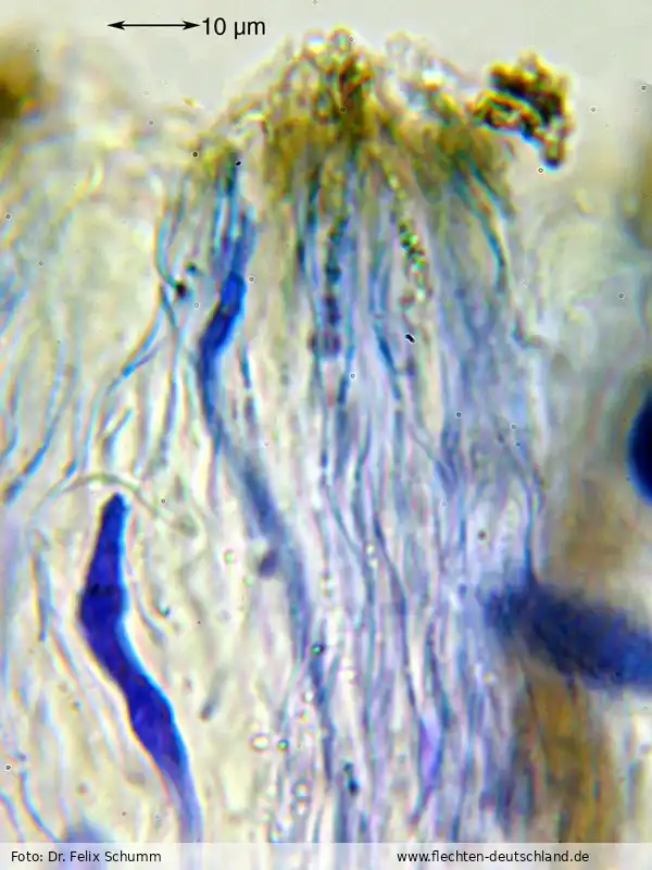 Fotografie Diploschistes diacapsis (Ach.) Lumbsch