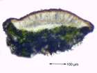 Lecanora hagenii (Ach.) Ach.