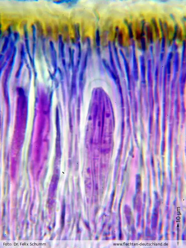 Sporen | Foto von Dr. Felix Schumm