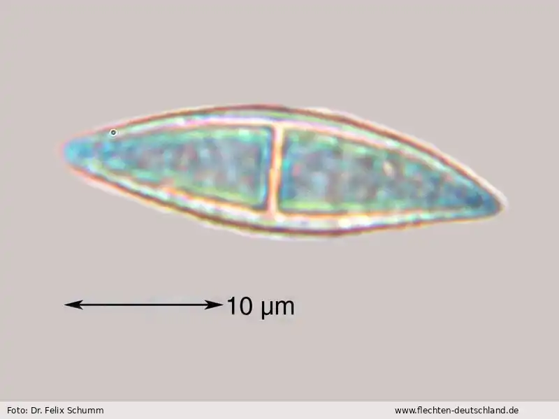 Querschnitt Fruchtkörper | Foto von Dr. Felix Schumm