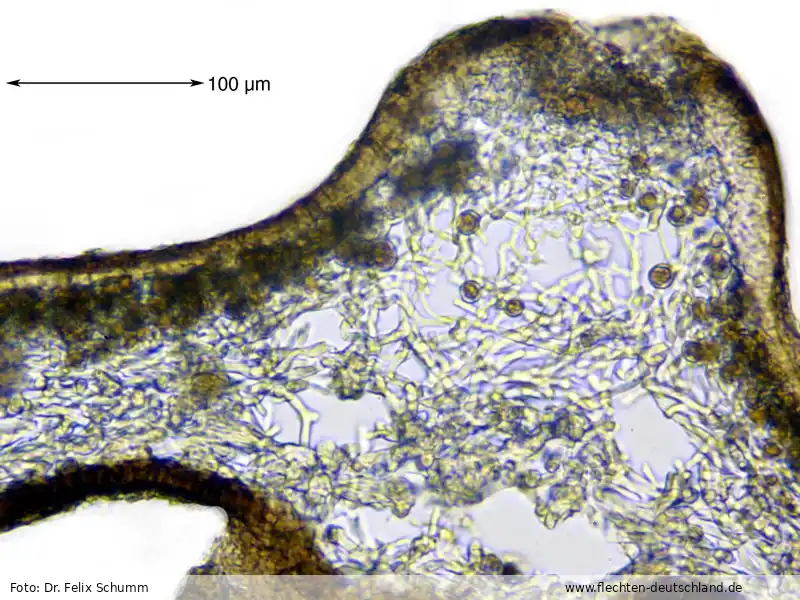 Mikromerkmale | Foto von Dr. Felix Schumm