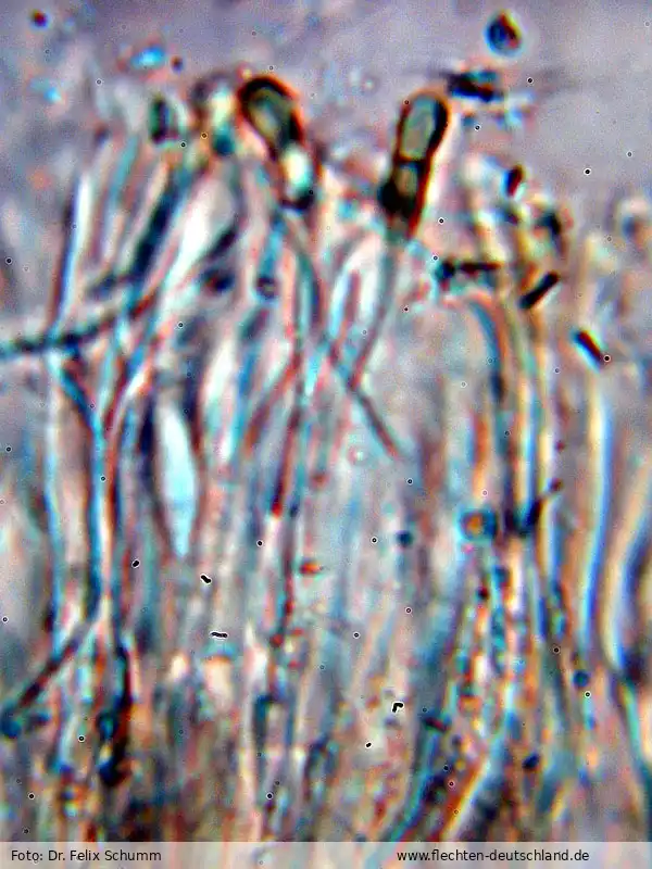 Fotografie Mycobilimbia sanguineoatra (Wulfen) Kalb & Hafellner