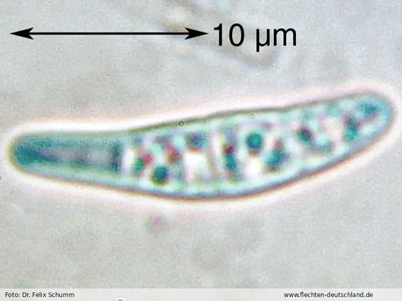 Querschnitt Fruchtkörper | Foto von Dr. Felix Schumm