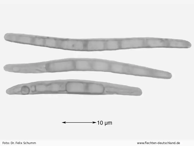 Querschnitt Fruchtkörper | Foto von Dr. Felix Schumm