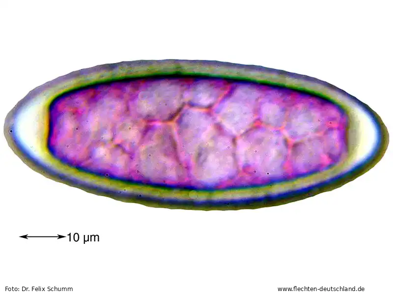 Sporen | Foto von Dr. Felix Schumm