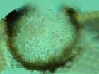 Phoma cytospora (Vouaux) D. Hawksw.