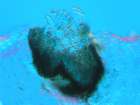 Vouauxiella lichenicola (Linds.) Petr. & Syd.